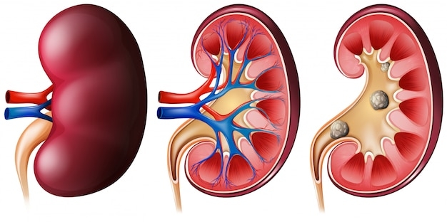 General Urology